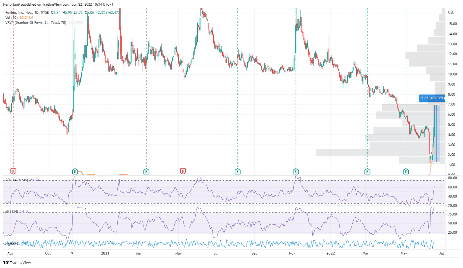 REV stock daily chart